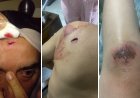 Caso de intolerancia en Facatativá deja tres personas lesionadas