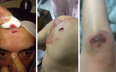 Caso de intolerancia en Facatativá deja tres personas lesionadas
