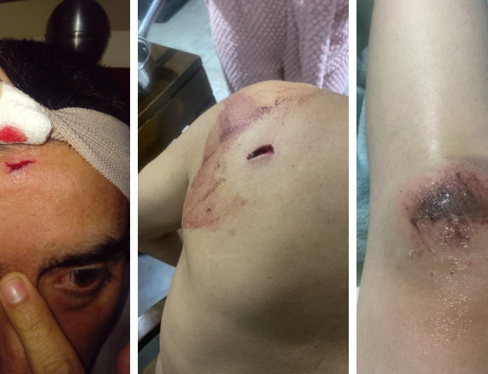 Caso de intolerancia en Facatativá deja tres personas lesionadas