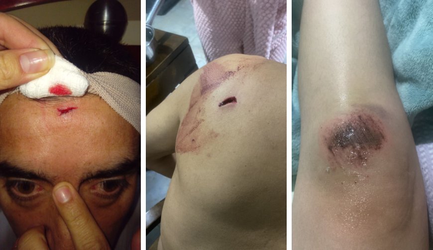 Caso de intolerancia en Facatativá deja tres personas lesionadas